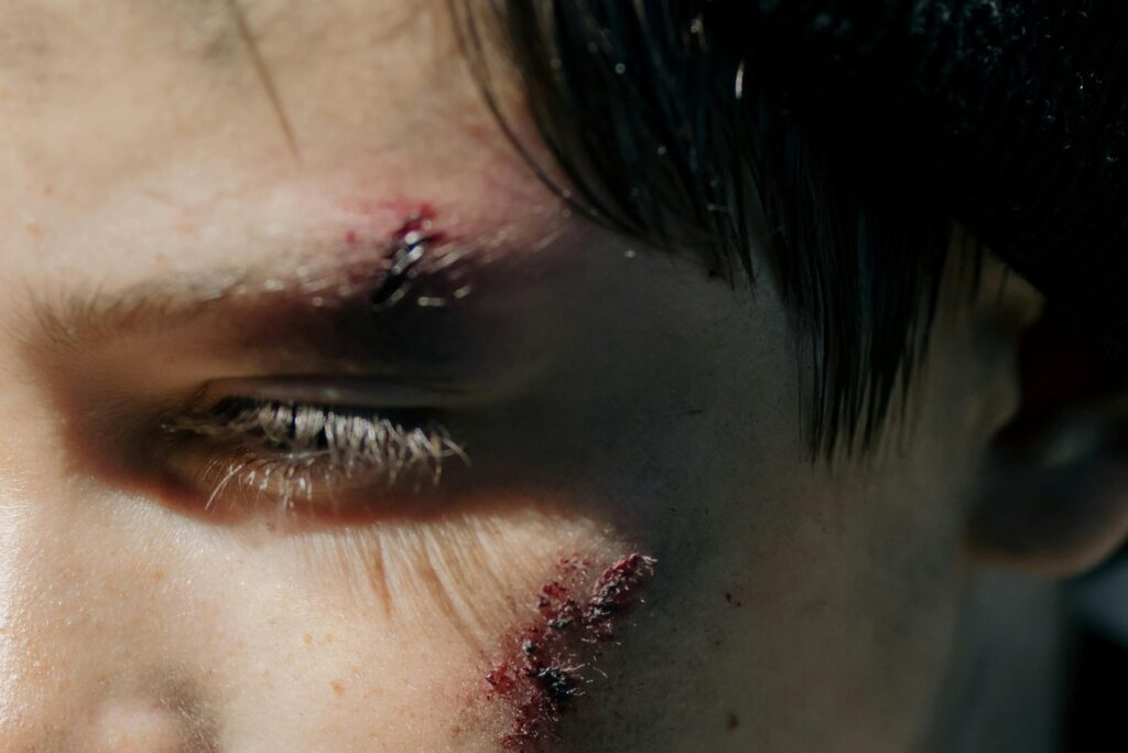 Intense close-up of a young person's face with visible wounds reflecting survival.