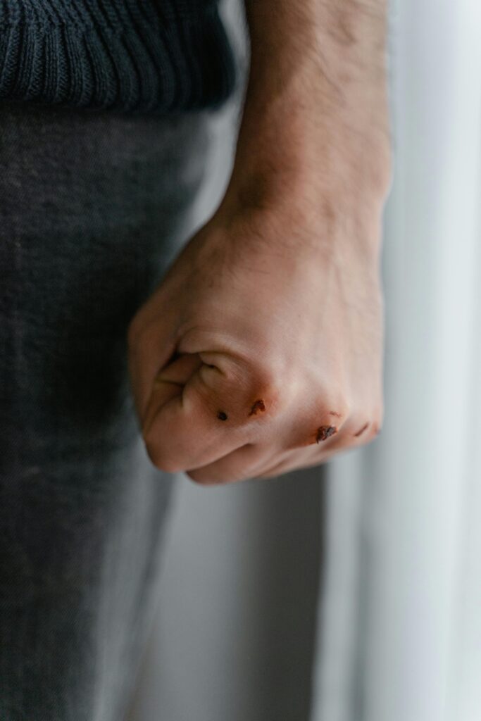 Detailed close-up of a clenched fist with minor wounds, showing human skin texture and emotion.